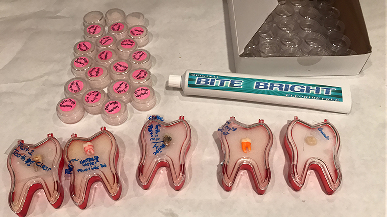 Exhibit one, two, three: A view of the wisdom teeth dipped in different fluids for Nikita Marino's Bite Bright product. Nikita also tested the effects of fluoride on teeth, which proved to be damaging to the enamel. Nikita invented Bite Bright fluoride-free toothpaste, which received approval from the U.S. Patent and Trademark Office in November 2020.