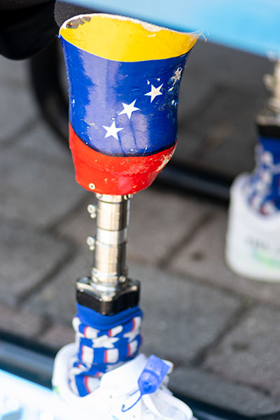 St. Thomas University student Franklin Mejias Castellano, who was left handicapped by an infection acquired during a trip to Florida from his native Venezuela when he was 12, has decorated his prosthetics with the Venezuelan and American flags.